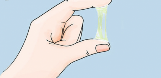 Khí hư màu vàng là biểu hiện của bệnh gì ? khí hư màu vàng