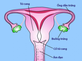Viêm vùng chậu là bệnh gì, có gây vô sinh không?